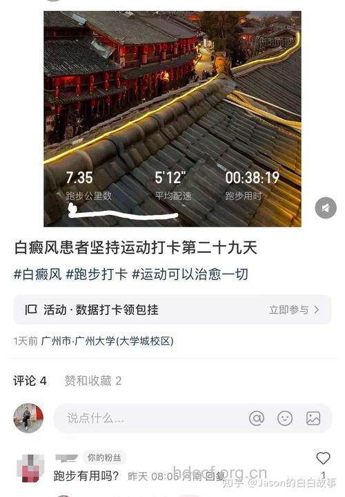 白癜风患者适合做哪些运动