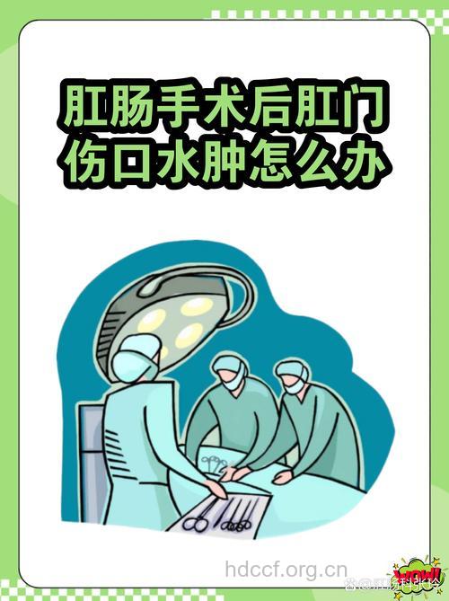 如何正确处理肛肠术后肛门水肿
