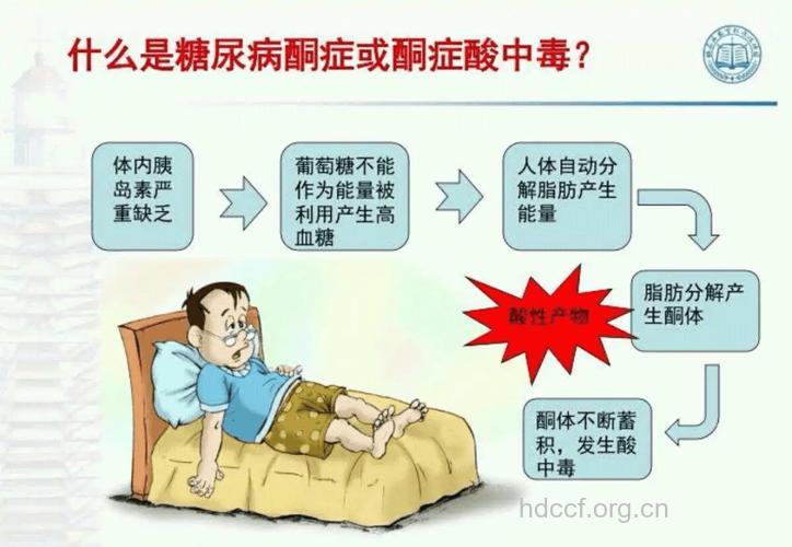 酮症酸中毒的诱因表现