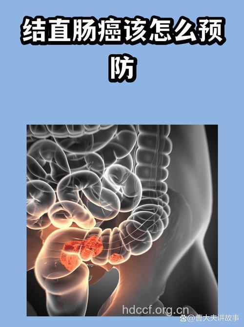 红肉导致结直肠癌 六个方法来预防