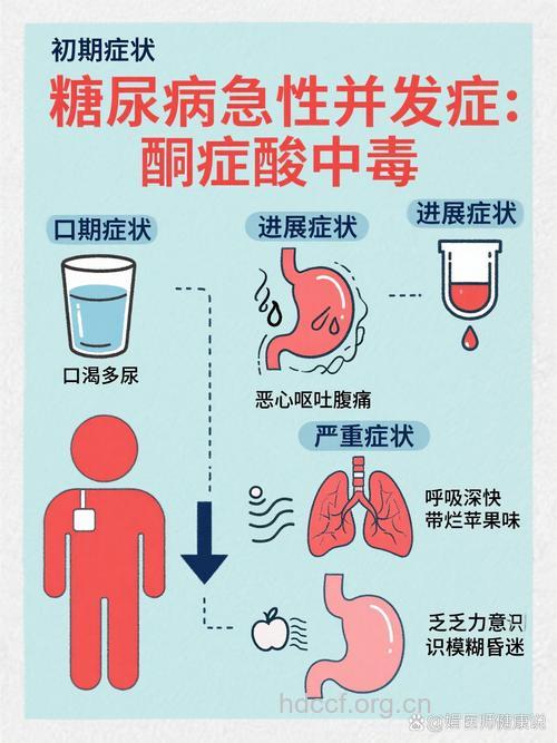酮症酸中毒的诱因及表现