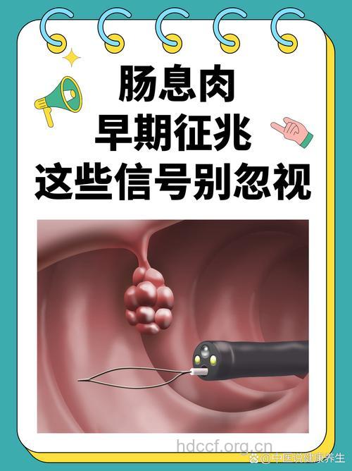 导致直肠息肉的2大凶手