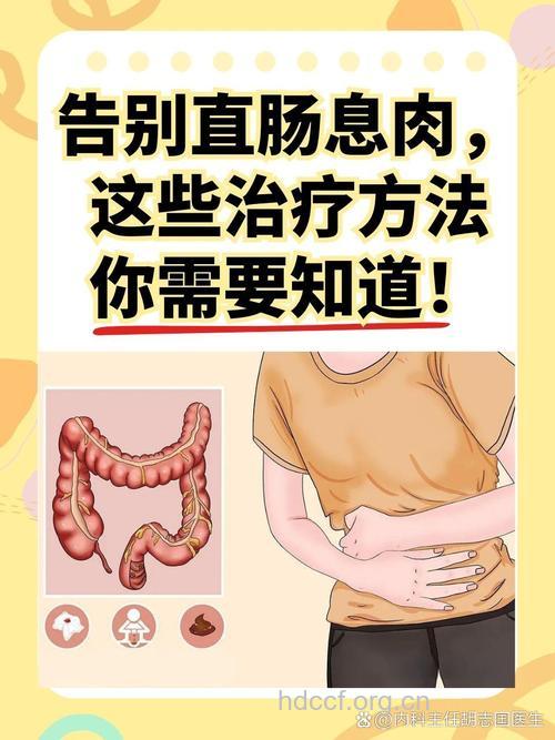 六种方法教你远离直肠息肉