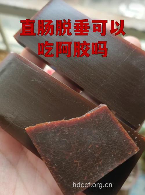直肠脱垂吃什么好 直肠脱垂的日常保健