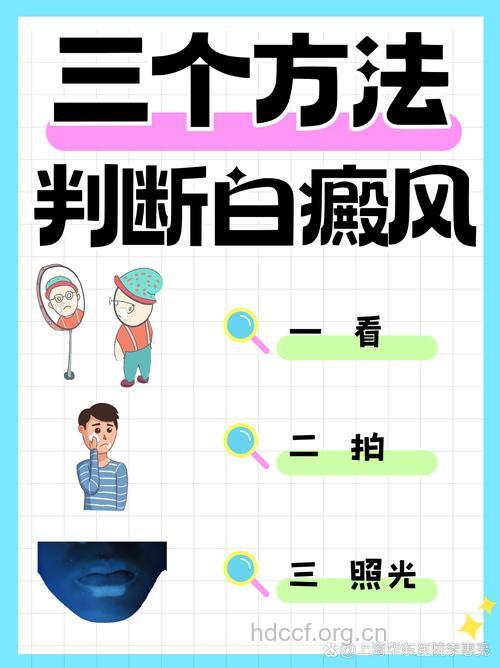 用科学的眼光看待“白癜风”