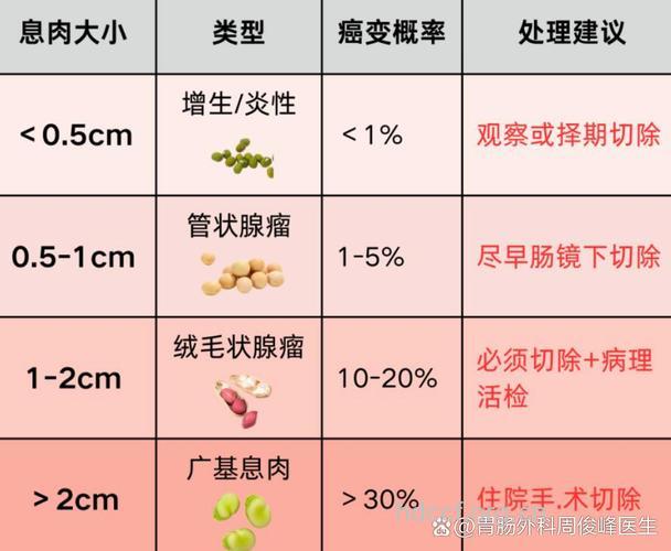 直肠息肉都有哪些分类