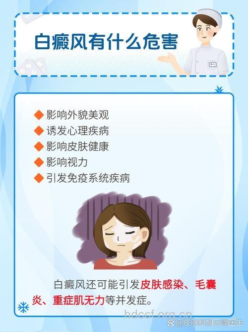 外因对白癜风治疗的影响