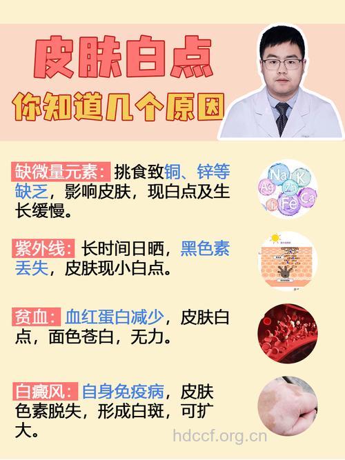 化妆品也会导致白癜风的原因