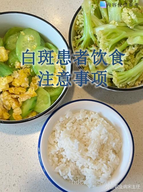 白癜风患者宜多喝酸奶