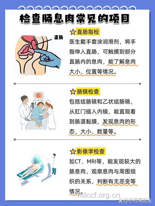 直肠息肉的检查方法有哪些