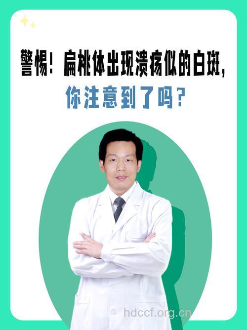 扁桃体炎引发白癜风吗