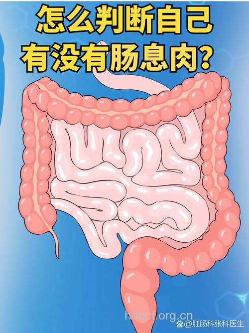 大肠息肉有哪些信号