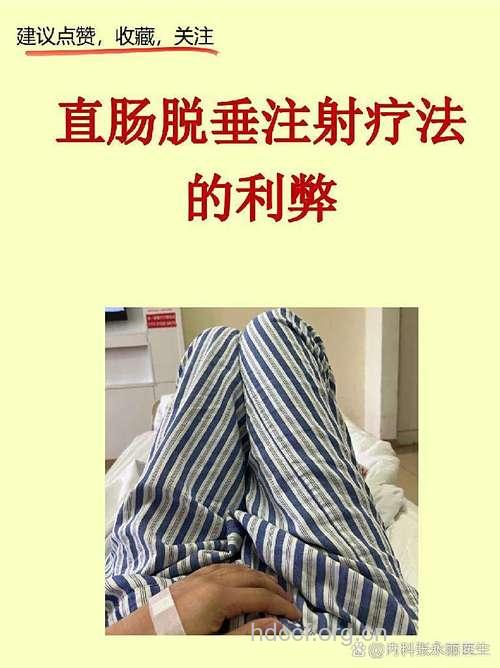 直肠脱垂的注射疗法