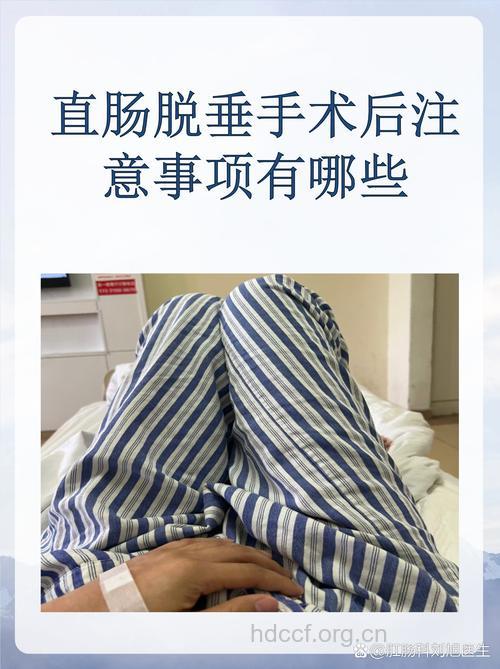 直肠脱垂有哪些手术方法