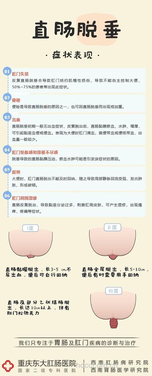 直肠脱垂的治疗方法