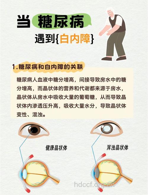 为何糖尿病患者会并发白内障