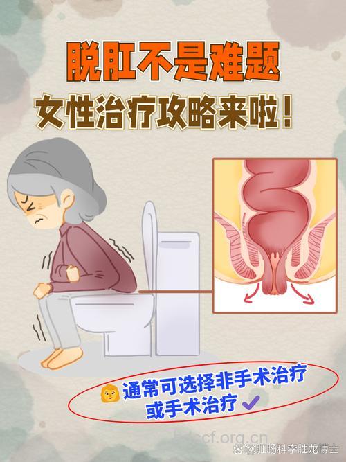 不同人得直肠脱垂治疗也不同