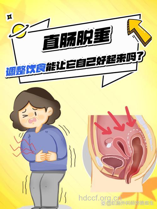 食疗措施缓解直肠脱垂