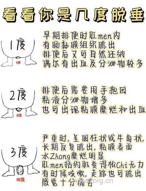 直肠脱垂患者的注意事项