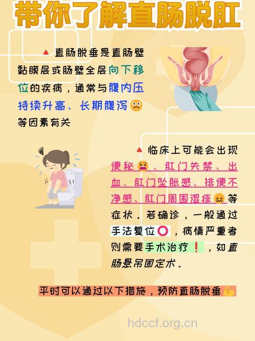 直肠脱垂该如何预防