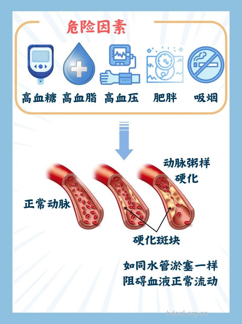 糖尿病会导致心血管疾病?