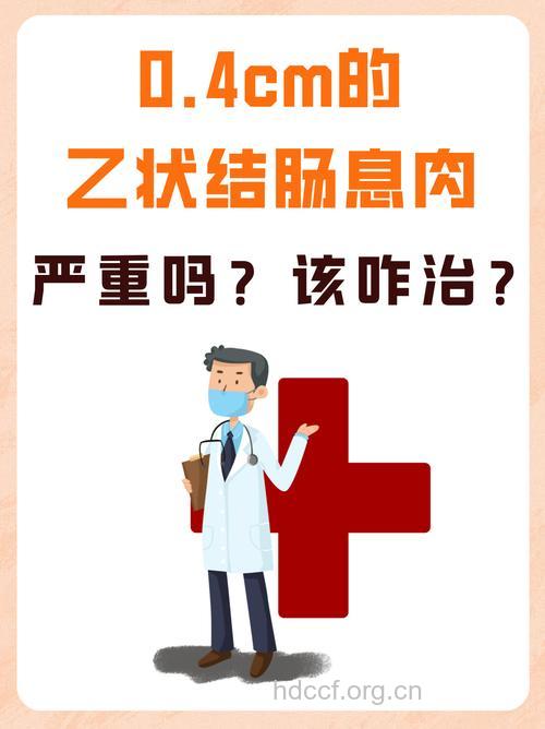 结肠息肉的保守治疗好吗