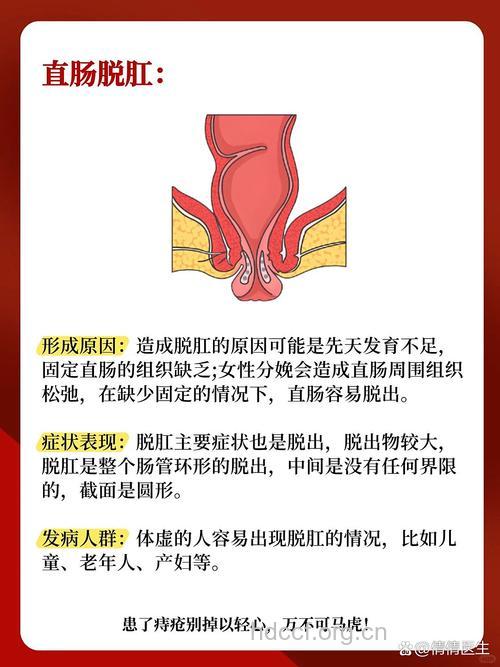 哪些人群易患直肠脱垂