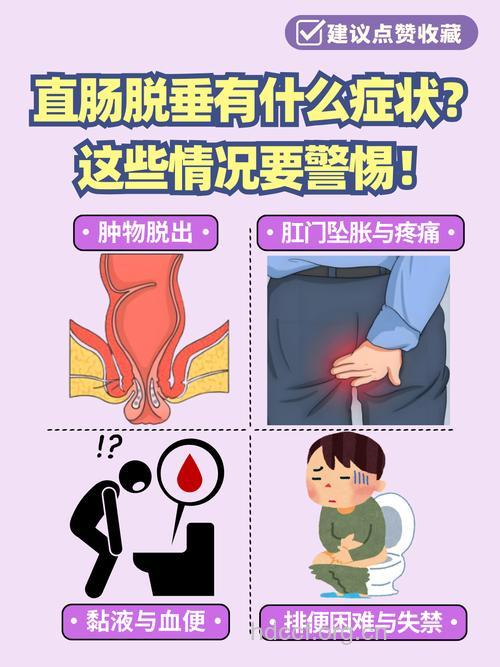 直肠脱垂患会出现的危害