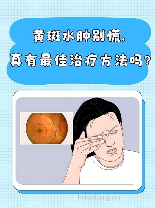 糖尿病可引发黄斑水肿 应早查早治