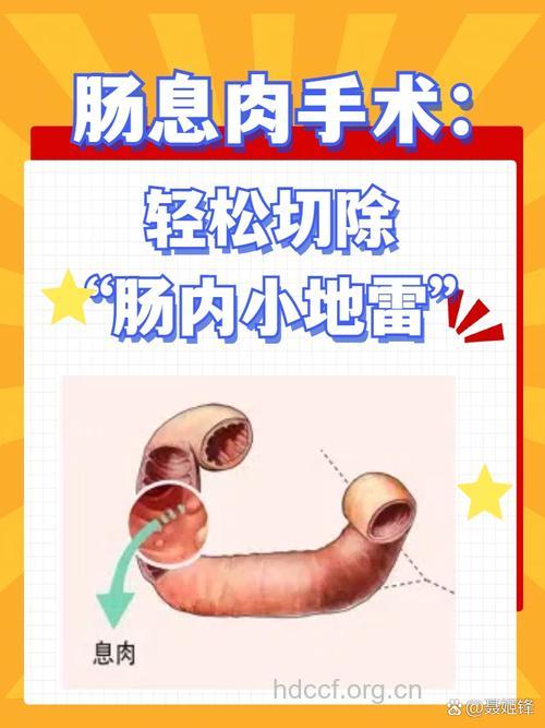怎么诊治直肠息肉方法