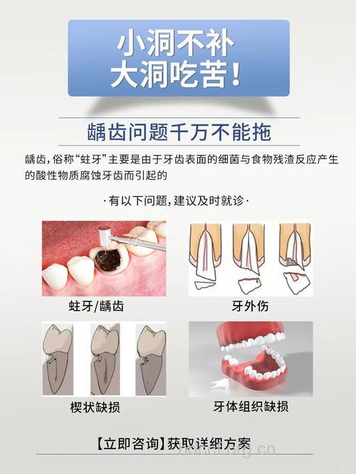 为什么大部分糖尿病患者都有坏牙