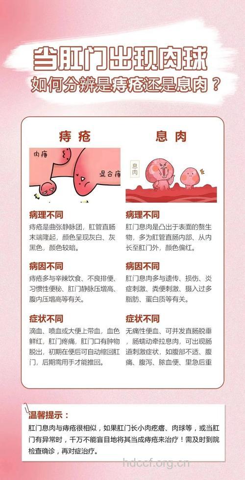 直肠息肉和痔疮怎么区别诊断