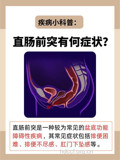 直肠前突疾病是怎么回事