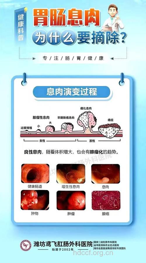 直肠息肉发病原因是什么