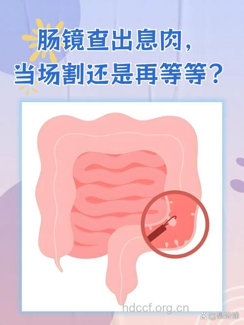 发现直肠息肉是否都得动刀