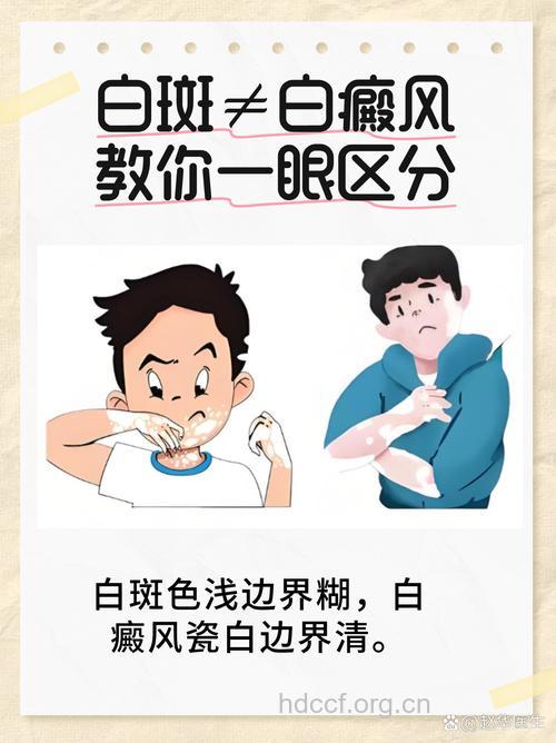 白癜风什么疾病有关系呢