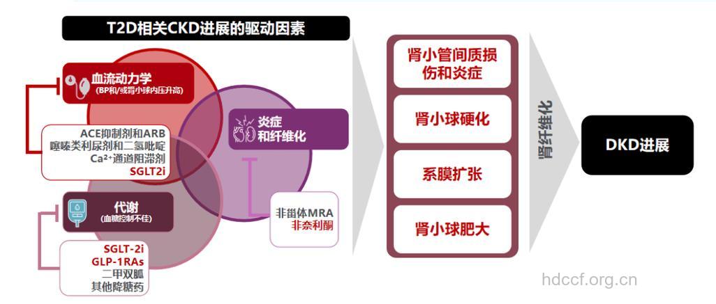 治疗糖尿病肾病的定律?