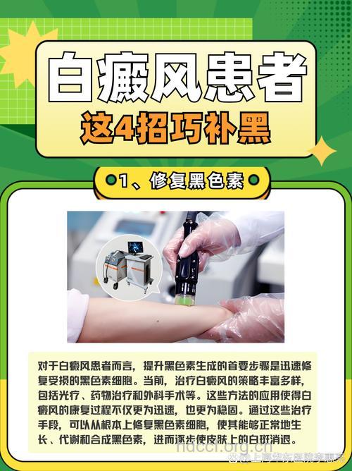 白癜风治疗的辅助方法