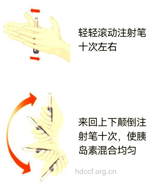 小窍门：胰岛素笔使用技巧