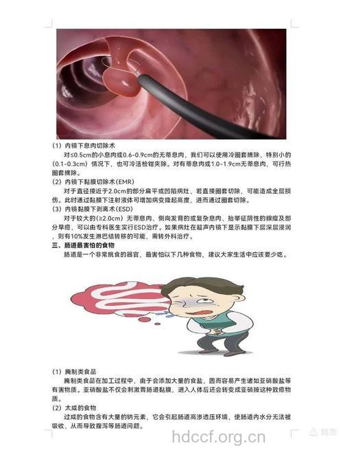 怎么治疗大肠息肉