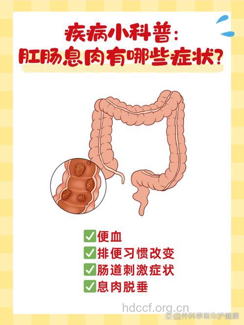 全面解析小儿直肠息肉
