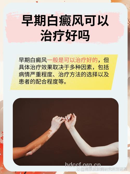 白癜风冬天终止治疗好不好?