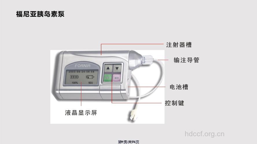 如何成功使用胰岛素泵