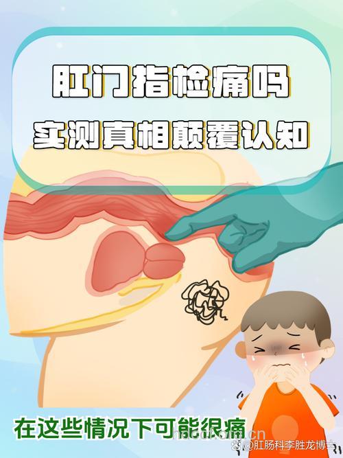 直肠指检“摸”出疾病