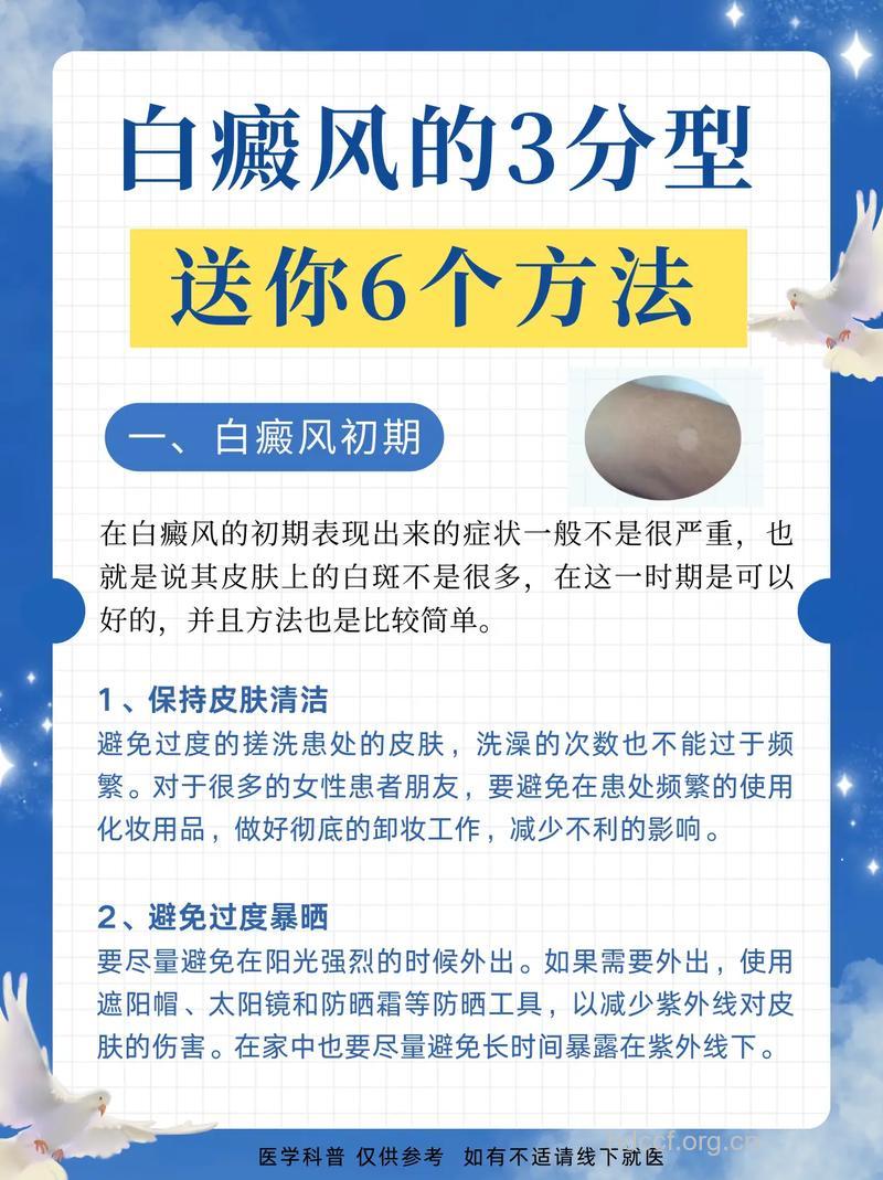 白癜风有什么治疗方法