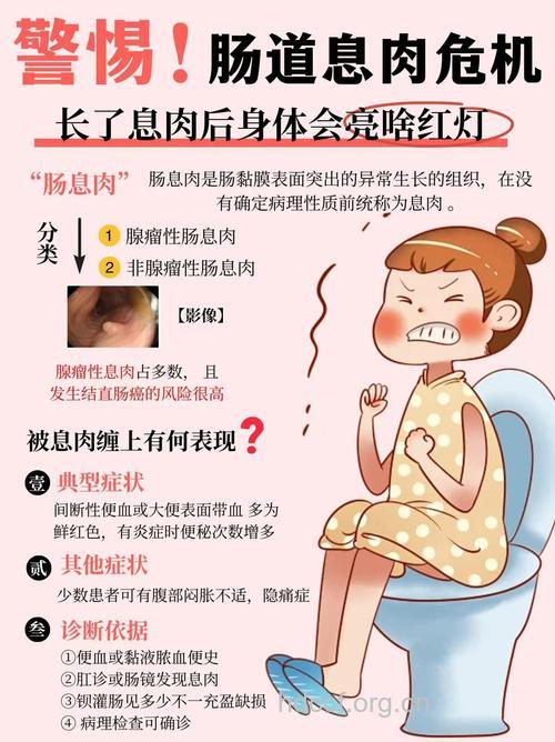 提示直肠息肉的几大症状