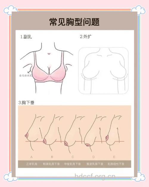女性乳房有什么秘密？