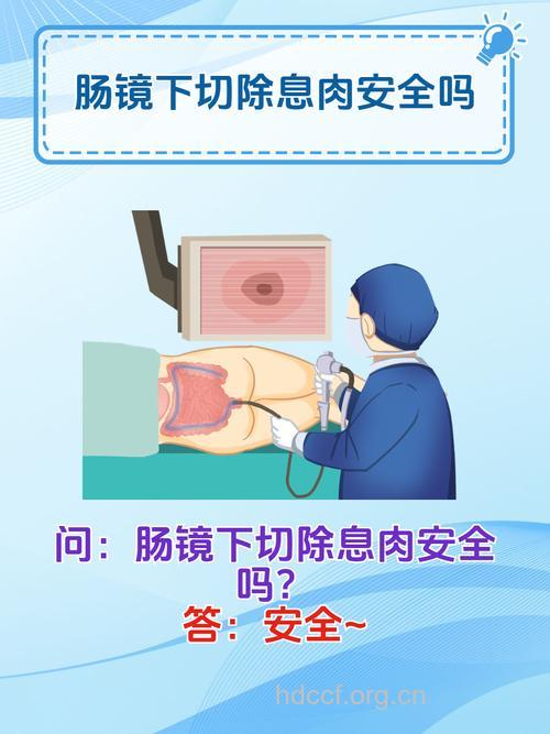 活检对于大肠息肉切除的重要性