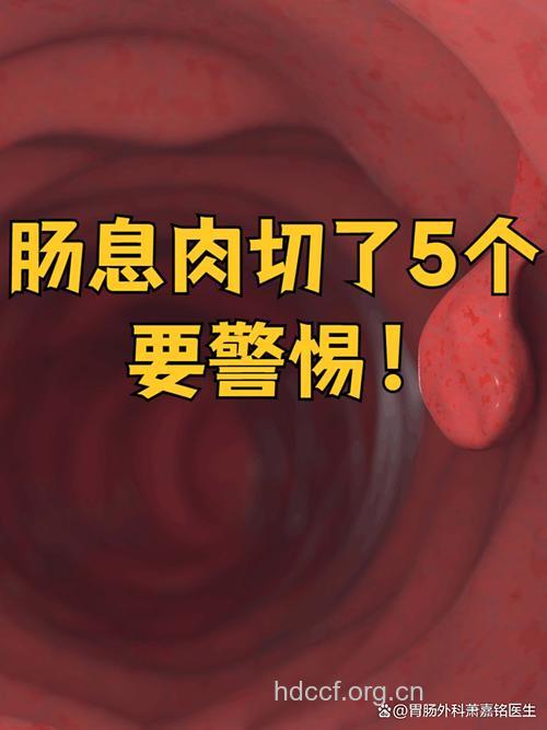 得了直肠息肉 有必要切除吗?