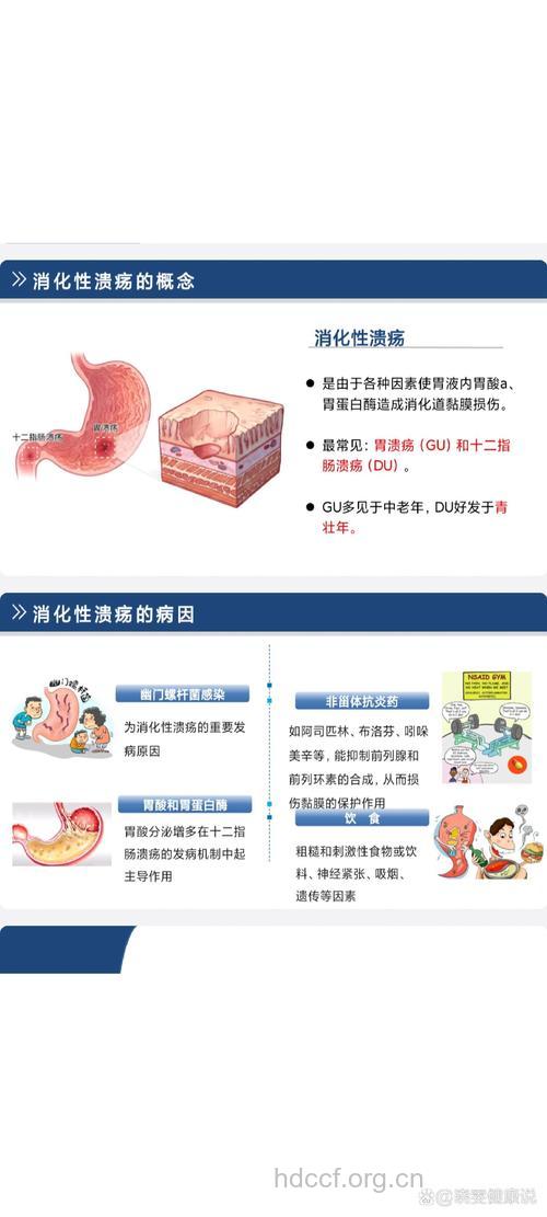 胃溃疡的病因及发病机理